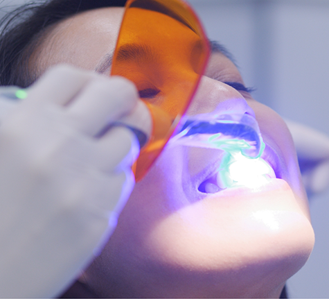 Dental patient getting bonding on a front tooth