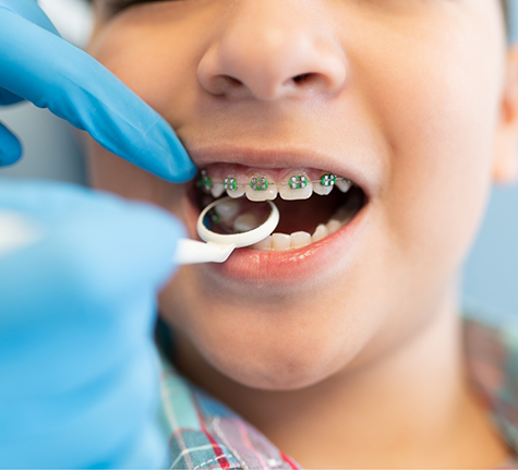 Person with braces getting a dental exam