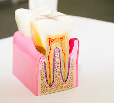 Model of a tooth showing the root canals inside of it