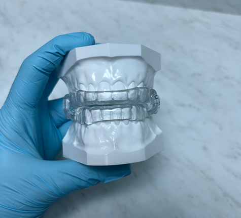 Dentist holding a model of the teeth with an oral appliance over the teeth